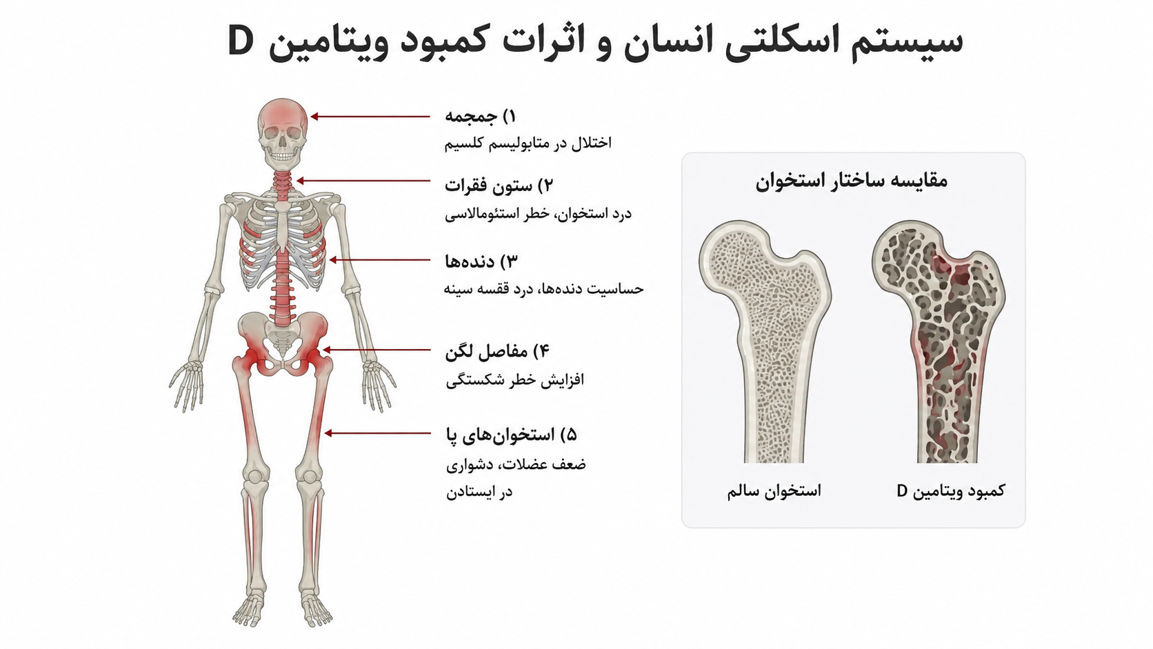 آزمایش ویتامین D