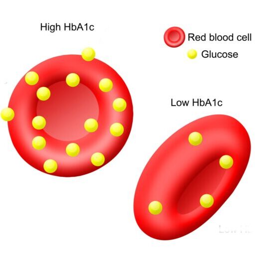 آزمایش HbA1c