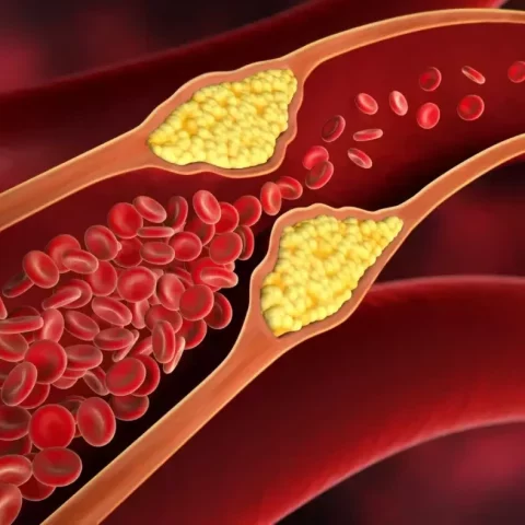 آزمایش کلسترول خون