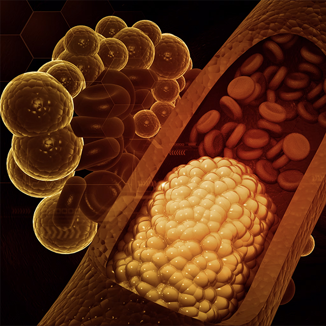 Cholesterol