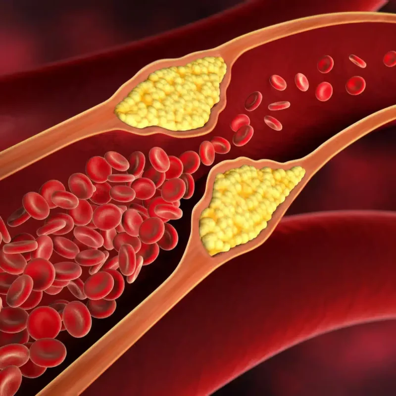 Cholesterol