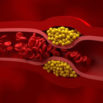 triglyceride تری‌گلیسرید